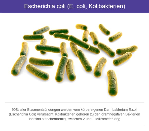 Escherichia coli