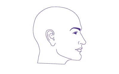 male-hair-loss-patern