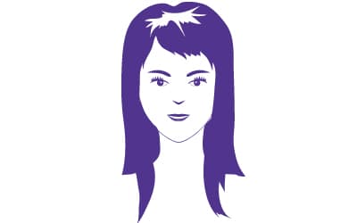 male-hair-loss-patern