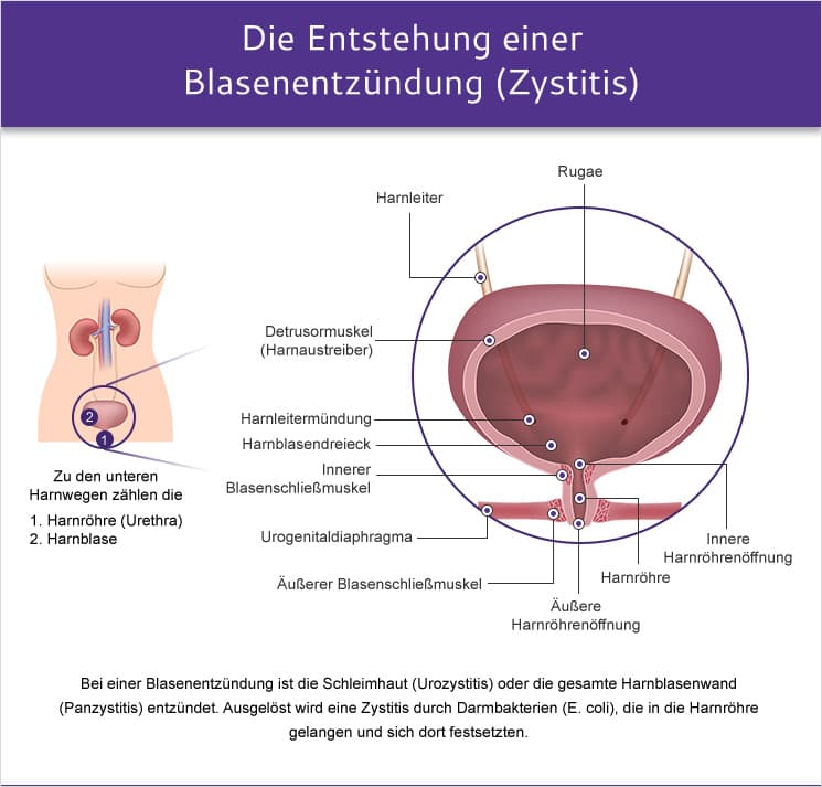 Ivermectin ohne rezept