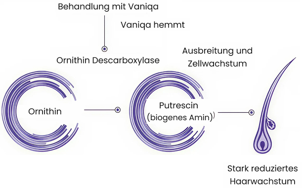 Wirkung von Eflornithin bei Hirsutismus