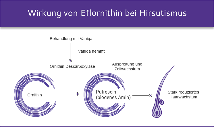 Wirkung von Eflornithin bei Hirsutismus