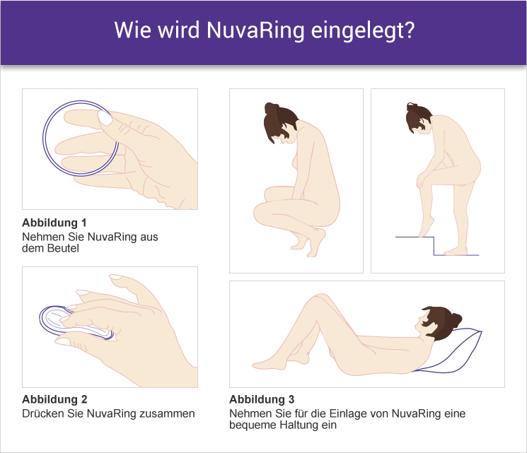 vaginalring anwendung