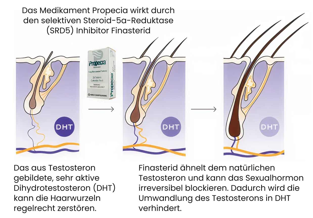 Wirkmechanismus von Finasterid (Propecia)