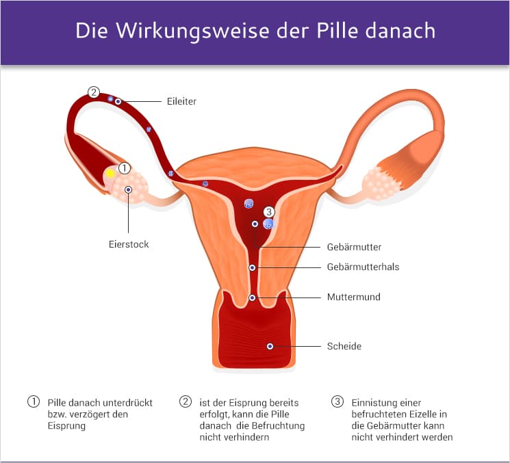 Die Wirkungsweise der Pille danach