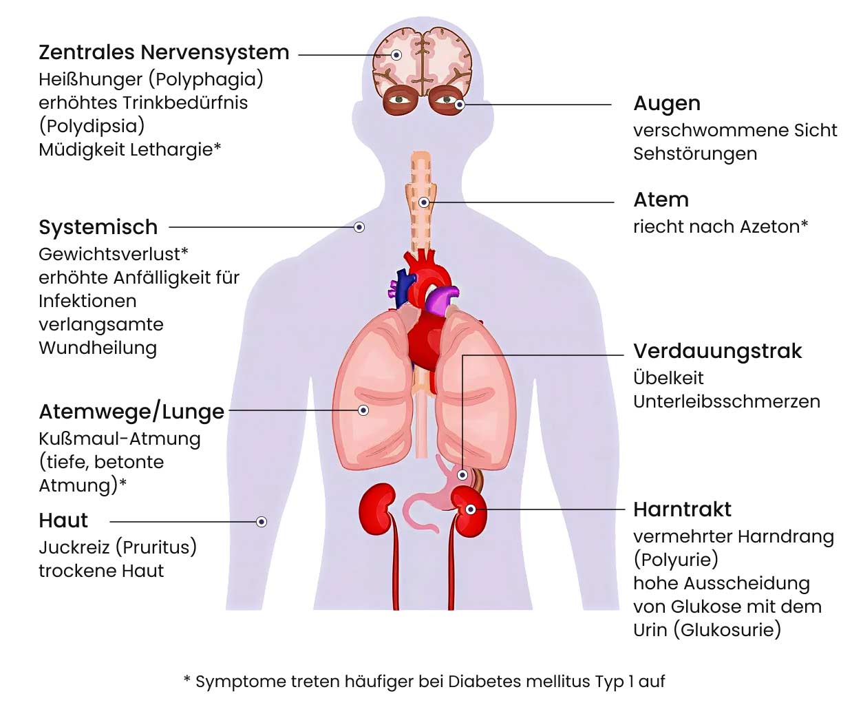 Typische Symptome von Diabetes mellitus