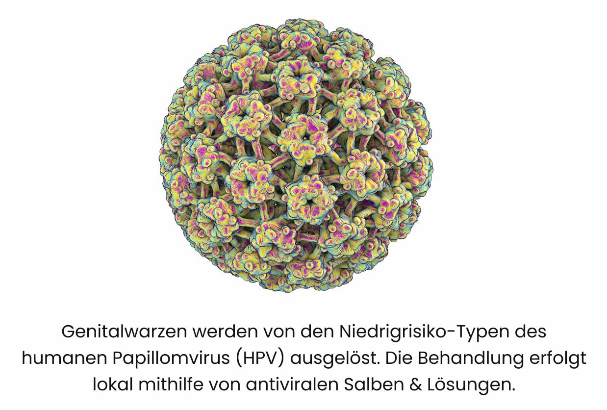 Auslöser von Genitalwarzen: Humane Papillom Viren (HPV)