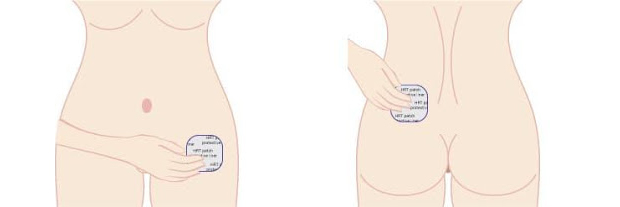  Estramon Conti Pflaster