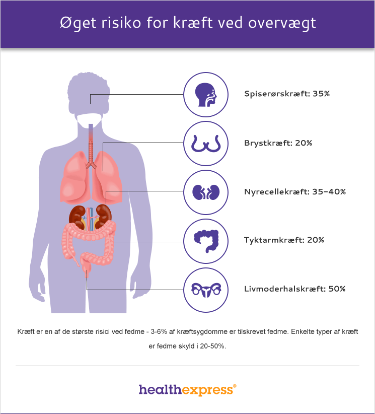 Overvægt øger risikoen for kræft
