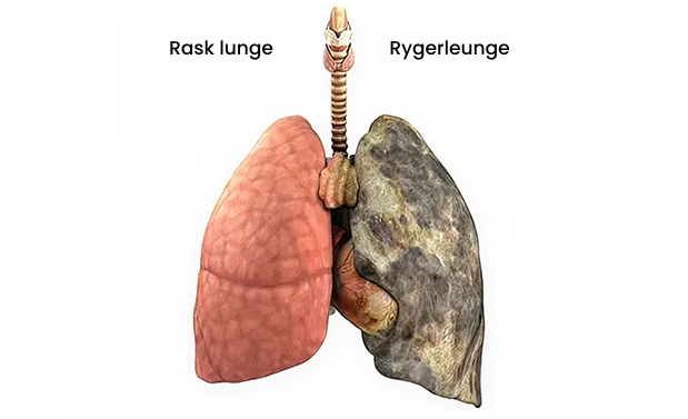 Rygning påvirker lungerne