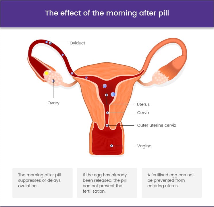 ᐅ Buy Emergency Contraception Online: Morning After Pill ...