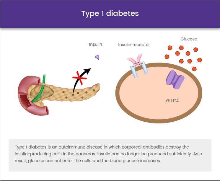 Lila Moss Type 1 Diabetes