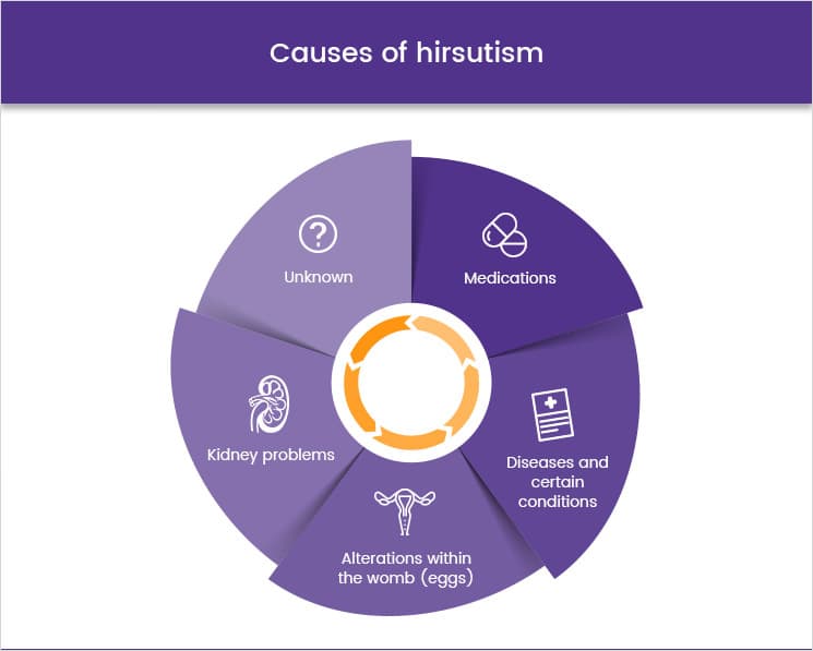 Causes of Hirsutism