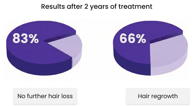 Finasteride clinical trials results