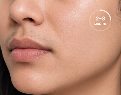 hair on upper lip after 2-3 months of treatment