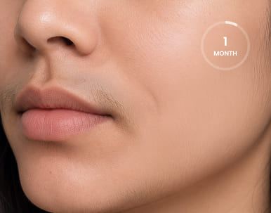 Hair on upper lip after 1 month of treatment