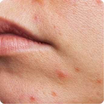 Close-up of calm, smooth skin