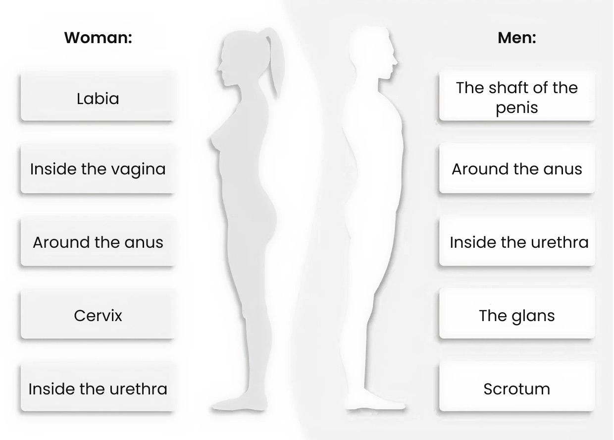 Areas where gential warts can occur