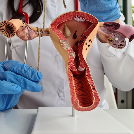 What you should know about permanent contraception