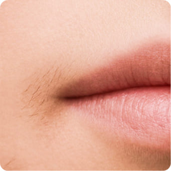 Close-up of skin showing lighter hair regrowth