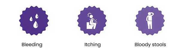 Symptoms of haemorrhoids