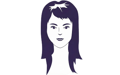 male-hair-loss-patern