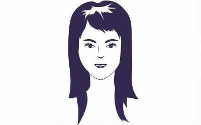 male-hair-loss-patern