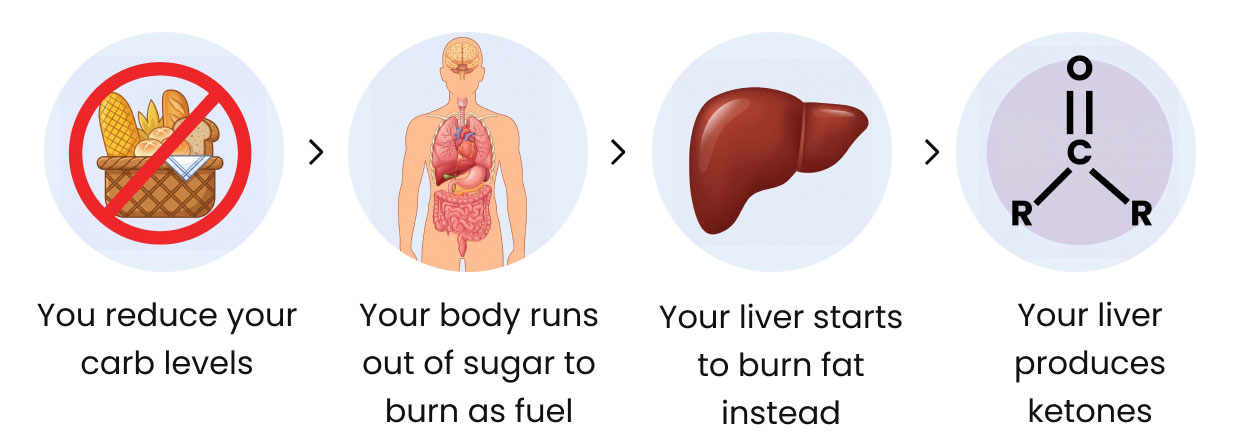 ketosis